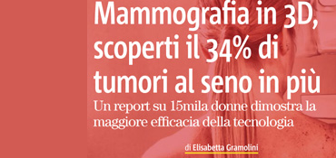 Intervista alla prof.ssa Adriana Bonifacino su “Il Giornale dei Biologi” - Mammografia in 3D, scoperti il 34% di tumori al seno in più