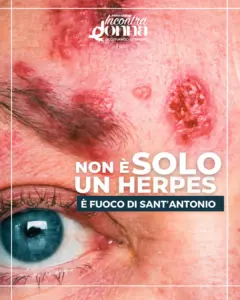 Alt(r)avoce – Fuoco di Santìantonio